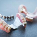 <strong>The Pros and Cons of Metal Partial Dentures, Explained</strong>