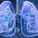 The Importance of Lung Cancer Screening: Early Detection Saves Lives