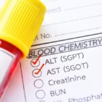 What causes high SGPT and SGOT levels?