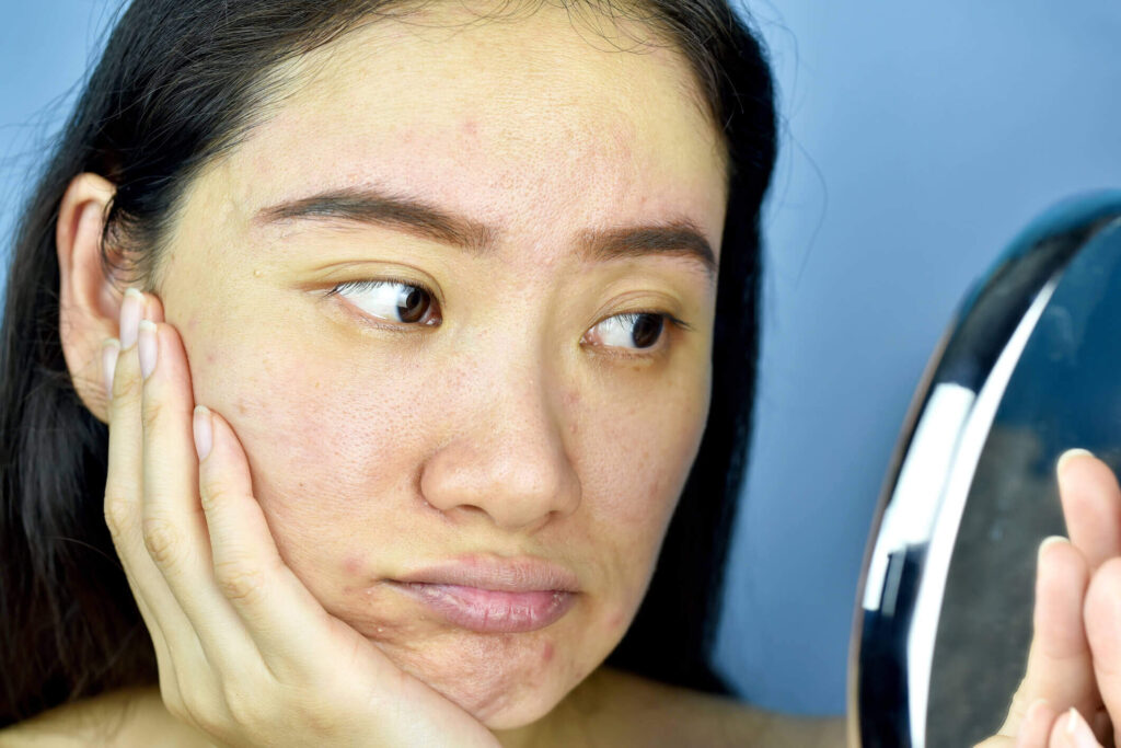 Pore Health 101: Dealing with Clogs and Dead Skin Cell Buildup