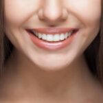 Achieving the Perfect Hollywood Smile with Veneers 