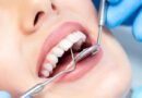 Achieving Optimal Dental Health: Importance of Regular Checkups