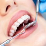 Achieving Optimal Dental Health: Importance of Regular Checkups