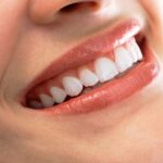 What to Expect During the Gum Graft Healing Process: Tips and Timeline