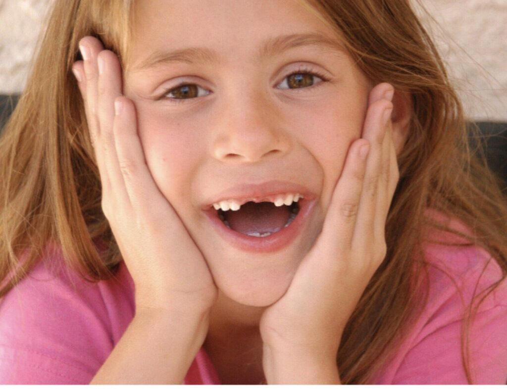Smile Confidently: Dental Options for Replacing a Missing Front Tooth