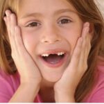 Smile Confidently: Dental Options for Replacing a Missing Front Tooth