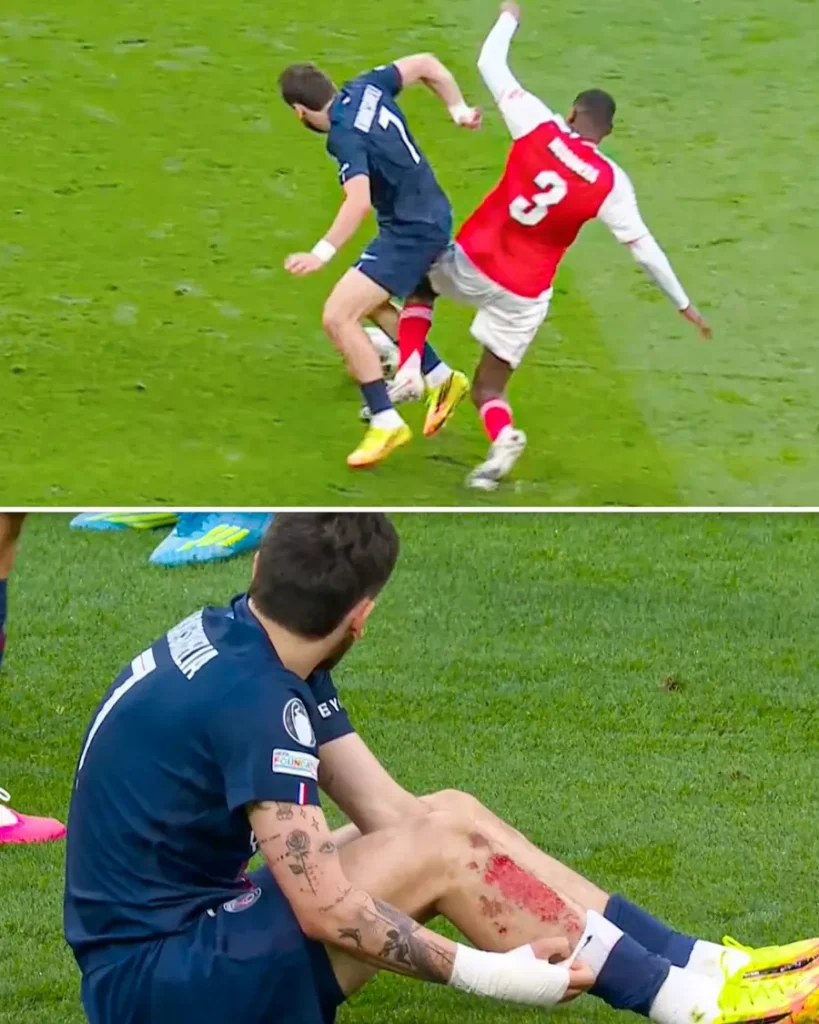 Kvaratskhelia Wins Fan Praise After Bloody PSG-Arsenal UCL Final Moment