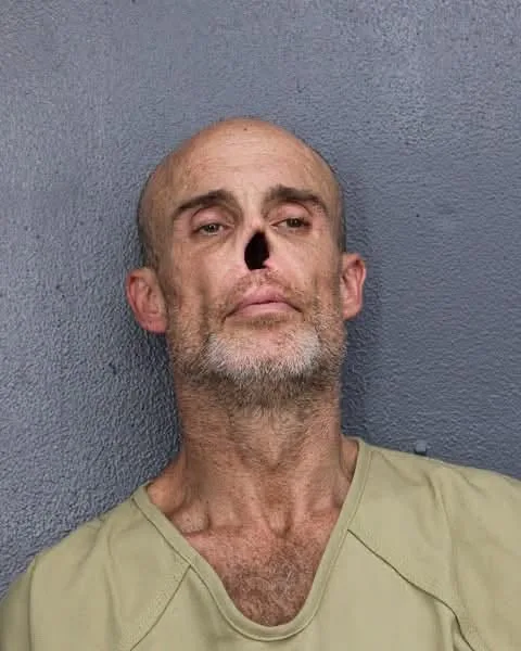Charles Wilson Pastore’s Mugshot Goes Viral — What Happened to His Nose?