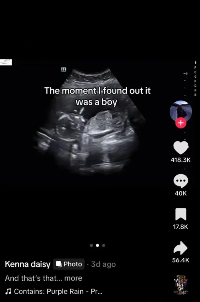 Kenna Daisy TikTok Sparks Outrage After Boy Ultrasound and Planned Parenthood Booking